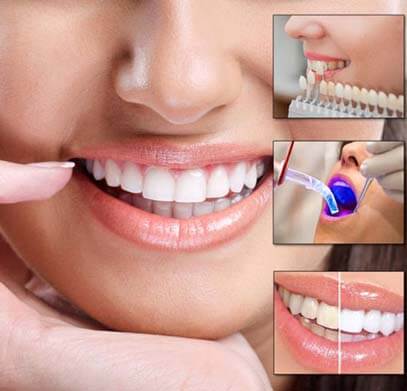 Dental Treatment
